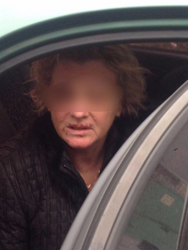 У Києві викрали та катували лікаря – просили викуп