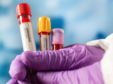 94 нових інфікованих і три смерті: повідомили про ситуацію з коронавірусом на Волині за добу