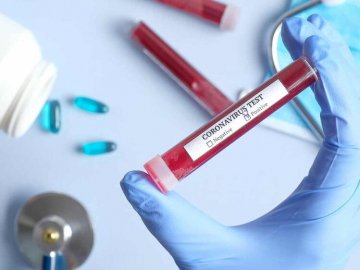 У селі на Волині, де виявили коронавірус у прихожан релігійної громади, захворіли двоє підлітків