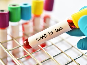 Коронавірус в Україні: повідомили про ситуацію за минулу добу