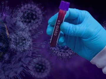 Оприлюднили статистику щодо коронавірусу в Україні за минулу добу