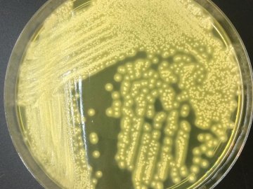 Розповіли, де на Волині у працівників освітніх закладів виявили стафілокок