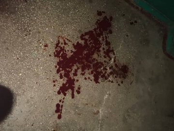 Хотів погуляти: лучанин зламав носа своїй дружині. ФОТО