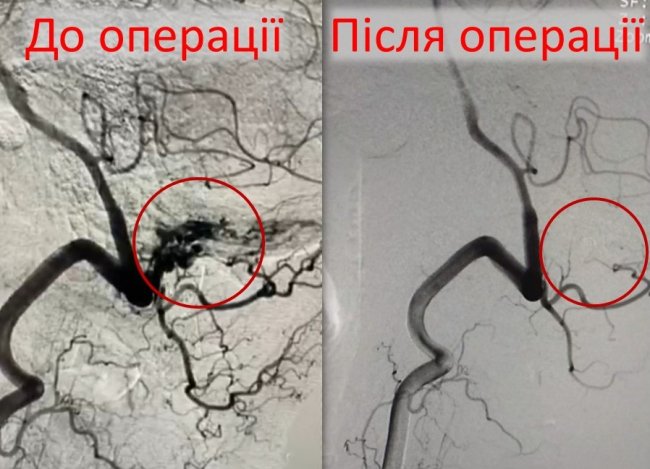 На Волині медики провели складну операцію чоловіку, який впав з висоти. ФОТО