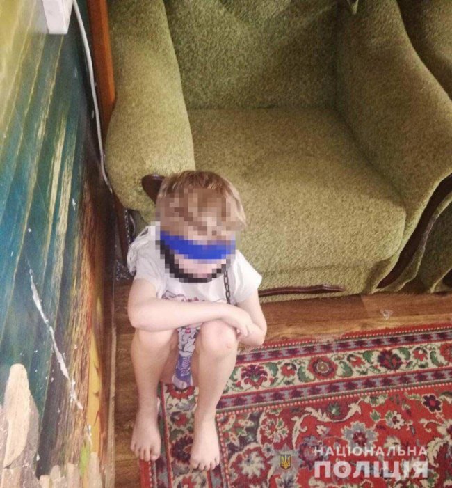 Обмотала скотчем і зав'язала очі: в Дніпрі жінка тримала 8-річну дитину на ланцюгу
