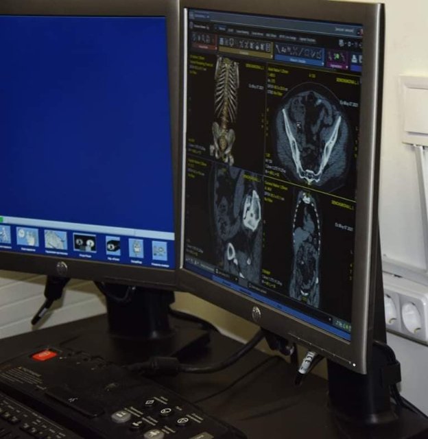 У волинському ТМО – нове високоточне обладнання. ФОТО