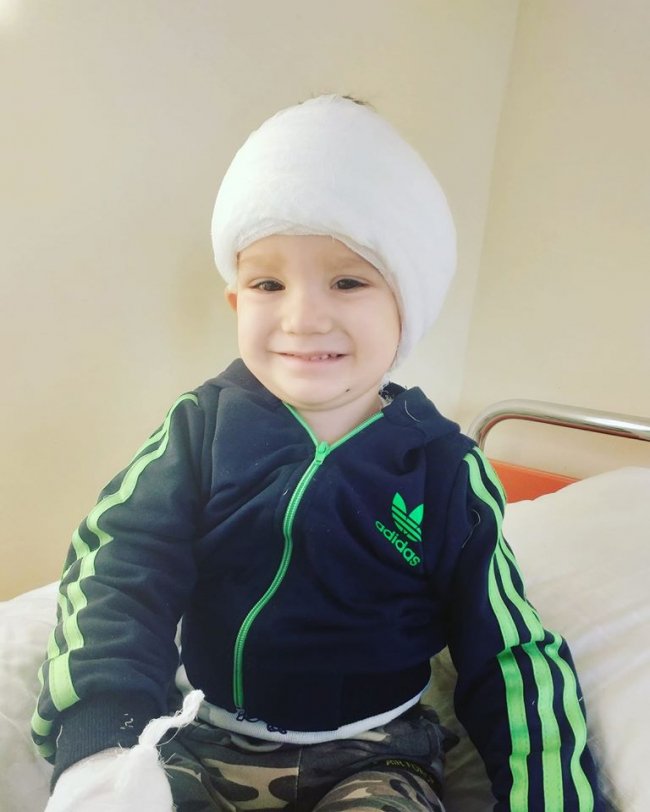 Вже зробили одну операцію, а на іншу збирають кошти: 2-річному хлопчику з Волині потрібна допомога