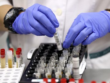 Коронавірус на Волині: повідомили ситуацію за минулу добу