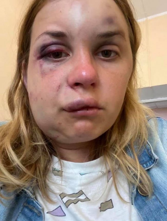 Побив та хотів зґвалтувати жінку в потязі: підозрюваного арештували