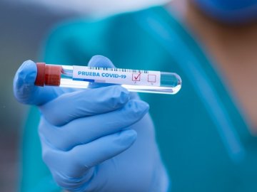 За добу COVID-19 підтвердили у 47 волинян