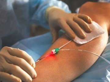 У медзакладі на Волині варикоз лікують сучасним методом