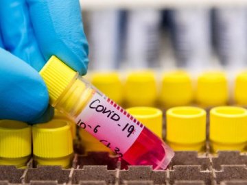 В Україні 2203 людини захворіли на коронавірус, 69 – померли