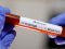 США скасовує тестування на коронавірус для туристів, – ЗМІ