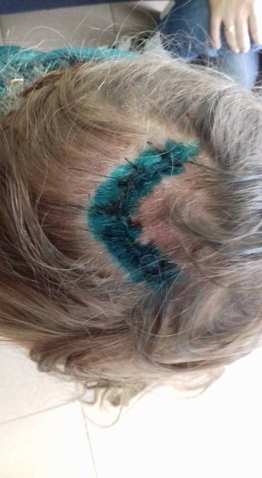 У Луцьку дівчинка впала в технічний люк. ФОТО