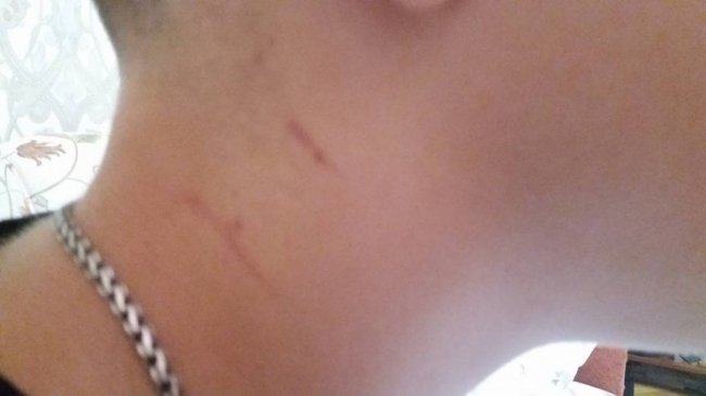 На дитмайданчику в Луцьку чоловік схопив хлопчика за горло