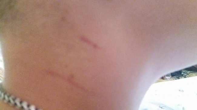 На дитмайданчику в Луцьку чоловік схопив хлопчика за горло