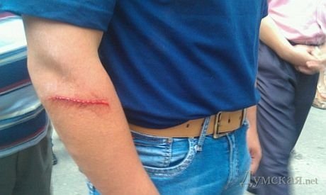 В Одесі свободівці та їхні противники вчинили масову бійку. ФОТО