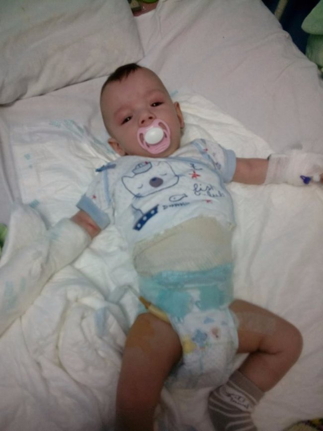 Волинян просять допомогти маленькому хлопчику