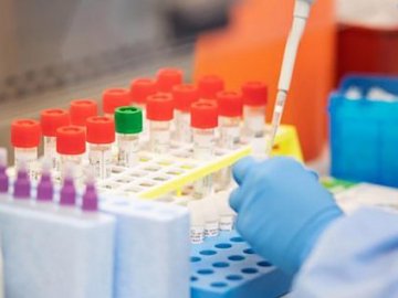 Де на Волині виявили нові випадки коронавірусу станом на ранок 24 травня