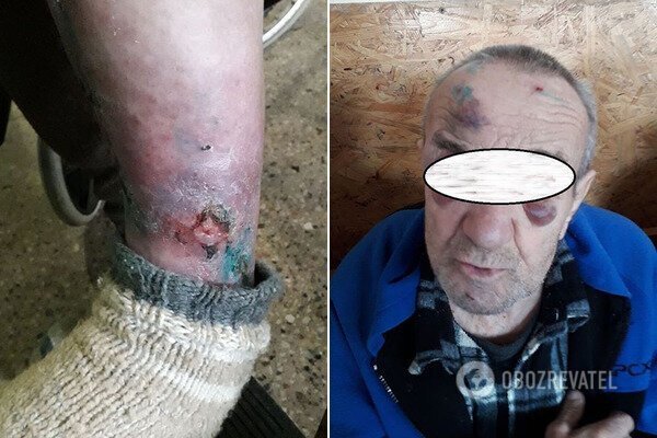 Примушували займатися сексом і катували: в інтернаті на Дніпропетровщині знущалися з хворих