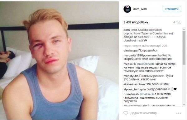 Побили відомого українського співака