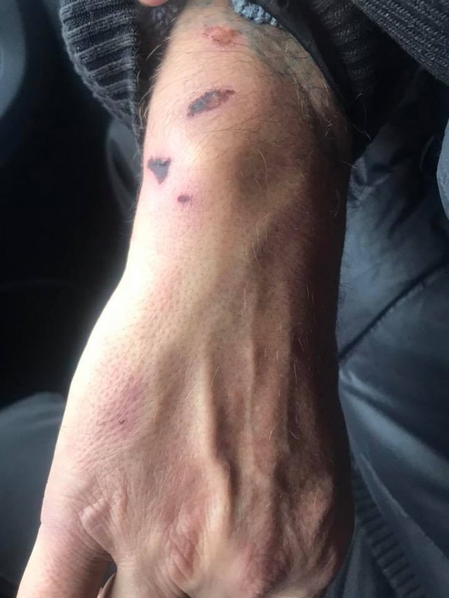 Викрали і катували: у Рівному підприємець зухвало побив свого працівника. ФОТО 18+