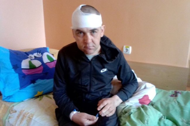 «Почав говорити, але ходити не може», – дружина побитого на Волині солдата