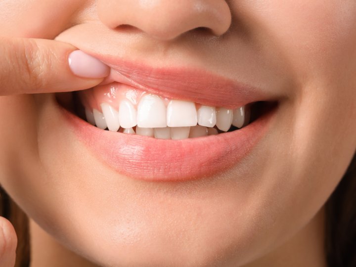 Сучасні технології відновлення зубів: чому варто обрати професійну імплантацію