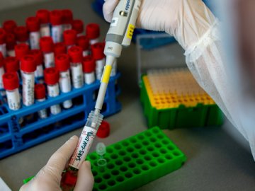 Де на Волині виявили нові випадки COVID-19 станом на 26 липня