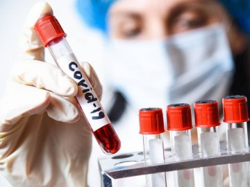 Степанов оприлюднив статистику щодо коронавірусу в Україні за минулу добу