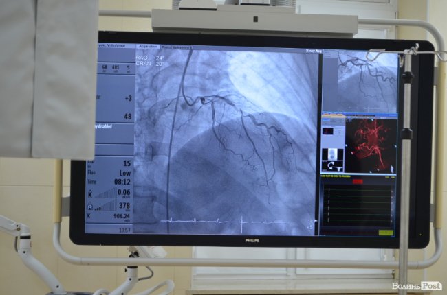 У Луцьку робитимуть унікальні операції на судинах. ФОТО