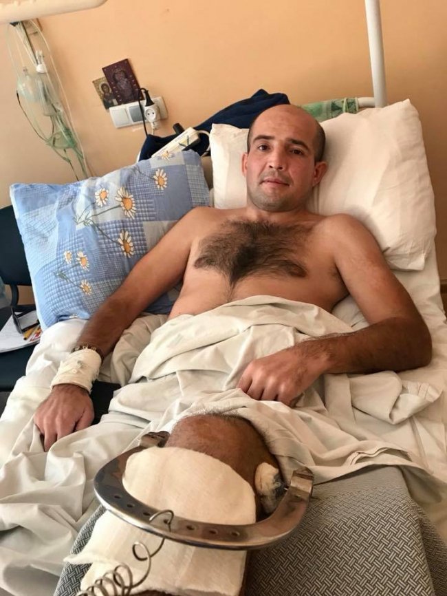 Важкопораненому волинянину потрібна допомога