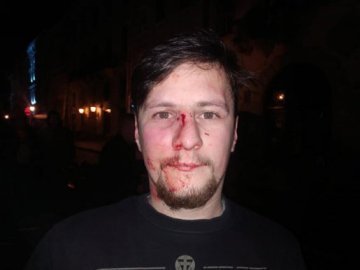 Волинському поліцейському, який побив ветеранів АТО у Львові, «світить» тюрма