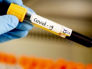 Нові випадки коронавірусу: захворіли стоматолог, працівник «Луцьктепла», медики наркодиспансеру