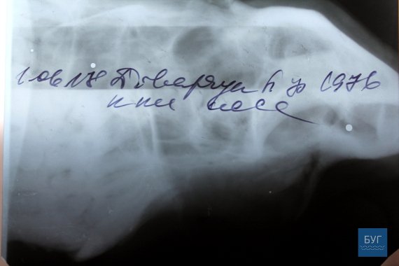 «Аліментів захотіла?» - на Волині чоловік побив колишню дружину. ФОТО. ВІДЕО. 18+