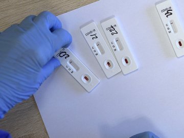 Лабораторний центр у Луцьку почав робити швидкі тести на коронавірус