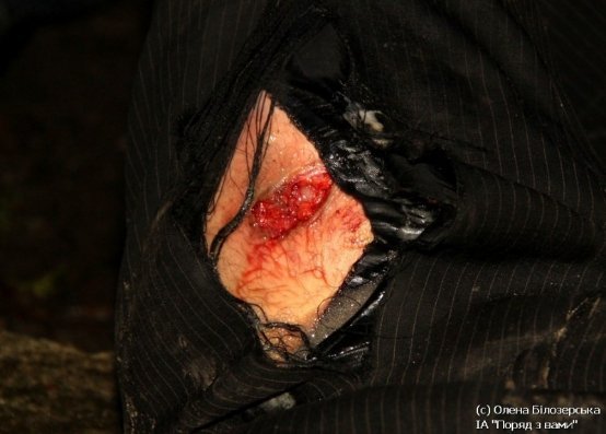 Як «Беркут» бив людей у Києві. ФОТО. ВІДЕО