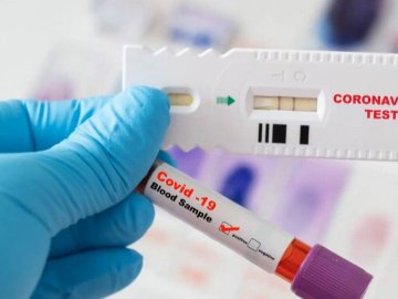 Лікарка-інфекціоністка пояснила, чому тести на коронавірус «помиляються»