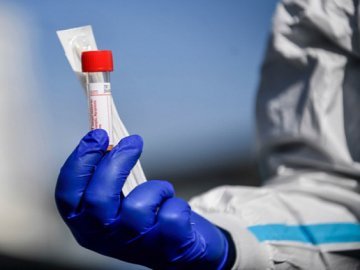 Коронавірус на Волині: за добу – 420 нових випадків, двоє людей померли
