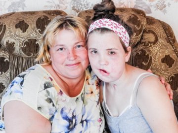 Постраждала в страшній аварії дівчина з Волині отримає нове обличчя