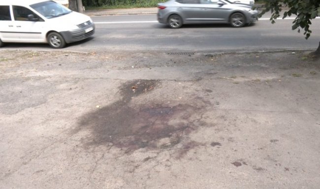 Травмована від вибуху гранати лучанка розповіла, як її врятував онук. ВІДЕО