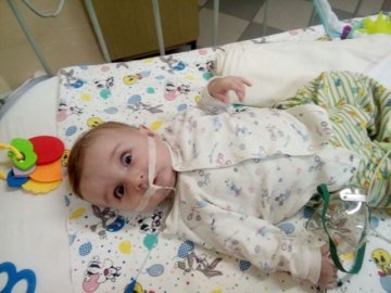 Не дихає, коли спить: у семимісячного волинянина з багатодітної сім’ї – рідкісна недуга