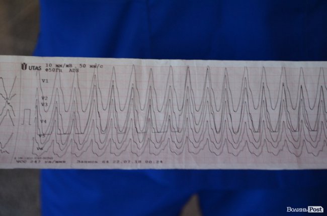 Волинянину вживили пристрій, який «повертає з того світу». ФОТО