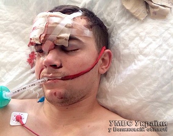 Аварія на Волині: правоохоронці просять допомогти встановити особу потерпілого. ФОТО