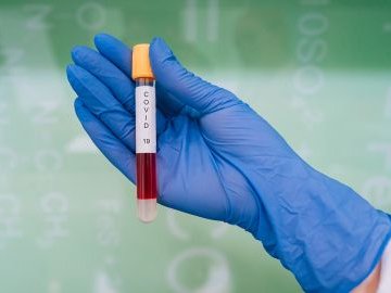 Оприлюднили статистику щодо коронавірусу в Україні за добу