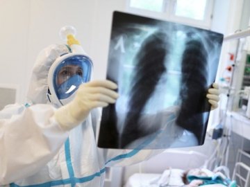 Лікарі назвали ознаки затяжного COVID і його наслідки