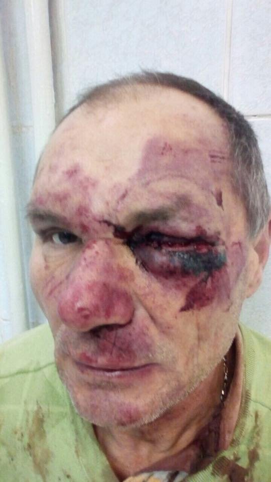 Викрали і катували: у Рівному підприємець зухвало побив свого працівника. ФОТО 18+