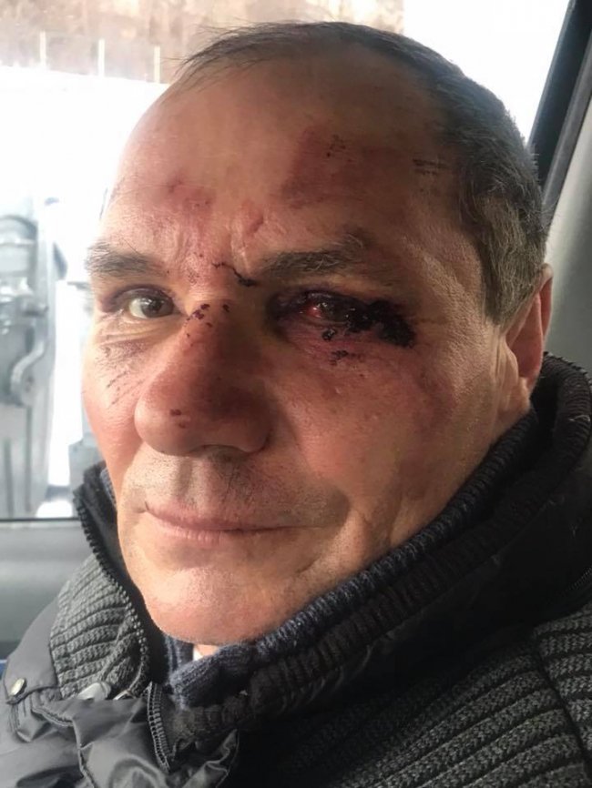 Викрали і катували: у Рівному підприємець зухвало побив свого працівника. ФОТО 18+