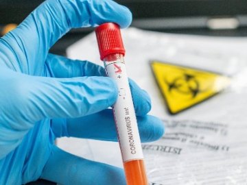 Три смерті та 138 нових випадків: ситуація з коронавірусом на Волині станом на 26 вересня