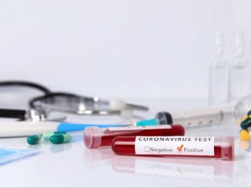 В Україні – 1112 нових випадків коронавірусу, з них на Волині – 60